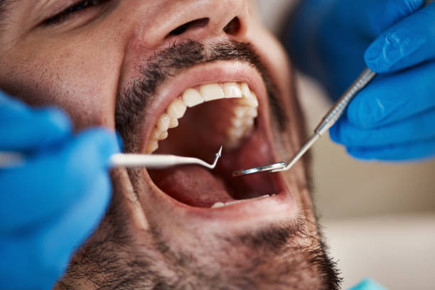 Best Tooth Infection Emergency Dentist  in La Plata, MD